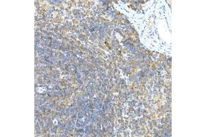 Immunohistochemistry of paraffin-embedded rat brain using LGR5/GPR49 Rabbit pAb  at dilution of 1:300 (40x lens). (LGR5 anticorps  (AA 824-907))