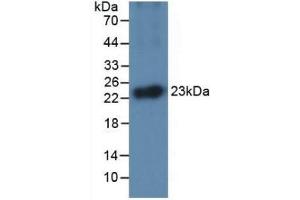Detection of Recombinant IL1a, Equine using Monoclonal Antibody to Interleukin 1 Alpha (IL1a) (IL1A anticorps  (AA 95-269))