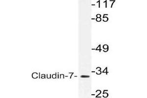 Western blot (WB) analysis of VDR antibody in extracts from rat liver cells. (Claudin 7 anticorps)