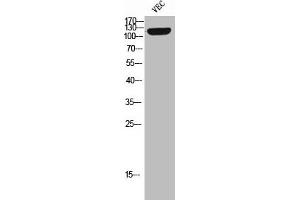 Western Blot analysis of VEC cells using Phospho-Tie-2 (Y992) Polyclonal Antibody (TEK anticorps  (pTyr992))