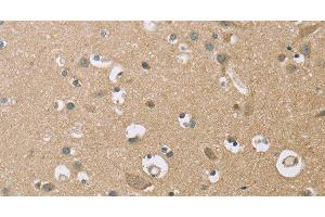 Immunohistochemistry of paraffin-embedded Human brain using ECHS1 Polyclonal Antibody at dilution of 1:35 (ECHS1 anticorps)