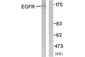 Western blot analysis of extracts from SK-OV3 cells, using EGFR (Ab-1070) Antibody. (EGFR anticorps  (AA 1041-1090))
