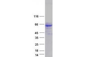 Validation with Western Blot (GBA Protein (Transcript Variant 3) (Myc-DYKDDDDK Tag))