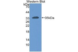 Western Blotting (WB) image for anti-Carcinoembryonic Antigen-Related Cell Adhesion Molecule 1 (CEACAM1) (AA 35-320) antibody (ABIN3201732) (CEACAM1 anticorps  (AA 35-320))