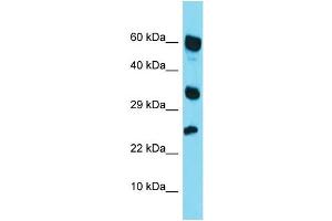 Western Blotting (WB) image for anti-Retinoic Acid Receptor Responder (Tazarotene Induced) 1 (RARRES1) (Middle Region) antibody (ABIN2499940) (RARRES1 anticorps  (Middle Region))