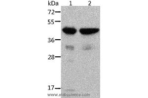 Western blot analysis of Mouse muscle and heart tissue, using ACTA1 Polyclonal Antibody at dilution of 1:500 (Actin anticorps)