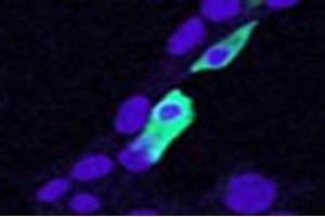 Immunofluorescence (IF) image for anti-Chloride Intracellular Channel 4 (CLIC4) antibody (ABIN5861496) (CLIC4 anticorps)