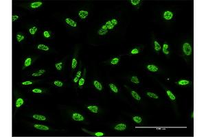 Immunofluorescence of monoclonal antibody to OXSR1 on HeLa cell. (OXSR1 anticorps  (AA 351-450))