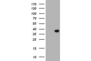 HEK293T cells were transfected with the pCMV6-ENTRY control (Left lane) or pCMV6-ENTRY LRRC39 (Right lane) cDNA for 48 hrs and lysed. (LRRC39 anticorps)