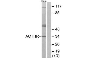Western Blotting (WB) image for anti-Melanocortin 2 Receptor (Adrenocorticotropic Hormone) (MC2R) (C-Term) antibody (ABIN1852922) (MC2R anticorps  (C-Term))