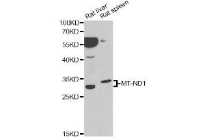 Western blot analysis of extracts of various cell lines, using MT-ND1 antibody (ABIN1873774) at 1:1000 dilution. (MT-ND1 anticorps)