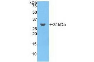 Detection of Recombinant FCN3, Human using Polyclonal Antibody to Ficolin 3 (FCN3) (FCN3 anticorps  (AA 34-297))
