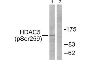 Western Blotting (WB) image for anti-Histone Deacetylase 5 (HDAC5) (pSer259) antibody (ABIN1847263) (HDAC5 anticorps  (pSer259))