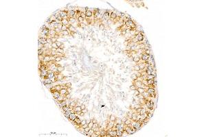 Immunohistochemistry of paraffin embedded rat testis using ctmp (ABIN7075880) at dilution of 1:200 (400x lens) (THEM4 anticorps)