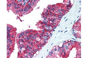 Anti-CD38 antibody IHC of human prostate. (CD38 anticorps  (C-Term))