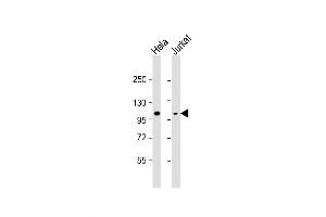 Western Blot at 1:8000 dilution Lane 1: Hela whole cell lysate Lane 2: Jurkat whole cell lysate Lysates/proteins at 20 ug per lane. (Retinoblastoma 1 anticorps  (C-Term))