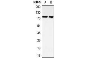Western blot analysis of LIMK1/2 expression in HeLa (A), SHSY5Y (B) whole cell lysates. (LIMK-1/2 (C-Term) anticorps)