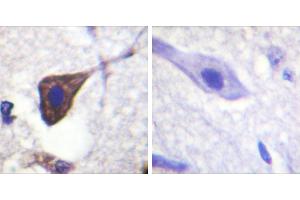 P-peptide - + (beta 2 Adrenergic Receptor anticorps  (pSer346))