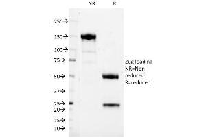 SDS-PAGE Analysis Purified CD37 Mouse Monoclonal Antibody (IPO24). (CD37 anticorps)