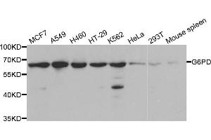 Western blot analysis of extracts of various cell lines, using G6PD antibody (ABIN5970726) at 1/1000 dilution. (Glucose-6-Phosphate Dehydrogenase anticorps)