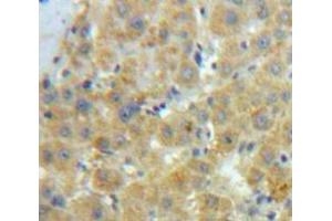 Used in DAB staining on fromalin fixed paraffin-embedded Liver tissue (Caldesmon anticorps  (AA 28-207))
