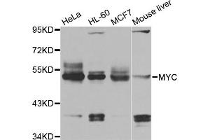 Western blot analysis of extracts of various cell lines, using MYC antibody (ABIN5996012) at 1/1000 dilution. (c-MYC anticorps)