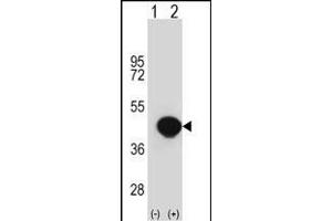 Western blot analysis of BGN (arrow) using rabbit polyclonal BGN Antibody (Center) (ABIN390701 and ABIN2840987). (Biglycan anticorps  (AA 148-176))