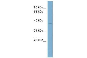 CAB39 antibody used at 1 ug/ml to detect target protein. (CAB39 anticorps  (Middle Region))