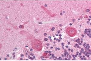 Immunohistochemistry (IHC) image for anti-V-Akt Murine Thymoma Viral Oncogene Homolog 3 (Protein Kinase B, Gamma) (AKT3) (AA 119-136) antibody (ABIN302246) (AKT3 anticorps  (AA 119-136))