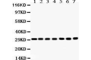 Western Blotting (WB) image for anti-Catechol-O-Methyltransferase (COMT) (AA 52-271) antibody (ABIN3043815) (COMT anticorps  (AA 52-271))