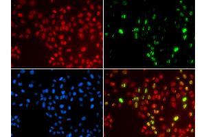 Immunofluorescence analysis of GFP-RNF168 transgenic U2OS cells using POLH antibody (ABIN5970934). (POLH anticorps)