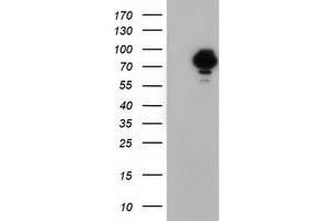 HEK293T cells were transfected with the pCMV6-ENTRY control (Left lane) or pCMV6-ENTRY VWA5A (Right lane) cDNA for 48 hrs and lysed. (VWA5A anticorps)