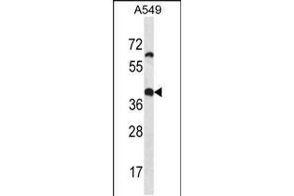 OR14J1 anticorps  (C-Term)