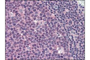 Immunohistochemistry (IHC) image for anti-Induced Myeloid Leukemia Cell Differentiation Protein Mcl-1 (MCL1) antibody (ABIN400763) (MCL-1 anticorps)