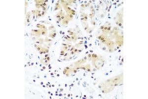 Immunohistochemistry of paraffin-embedded human stomach using AGO2 antibody. (AGO2 anticorps)