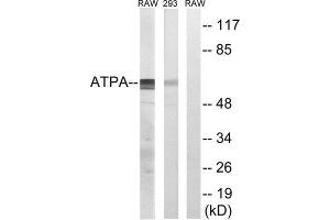 Western Blotting (WB) image for anti-ATP Synthase, H+ Transporting, Mitochondrial F1 Complex, alpha Subunit 1, Cardiac Muscle (ATP5A1) (Internal Region) antibody (ABIN1850830) (ATP5A1 anticorps  (Internal Region))
