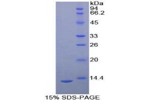 SDS-PAGE analysis of Human uPAR Protein. (PLAUR Protéine)