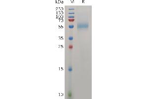 Human ZP3 Protein, His Tag on SDS-PAGE under reducing condition. (Zona Pellucida Glycoprotein 3 Protein (ZP3) (AA 23-386) (His tag))