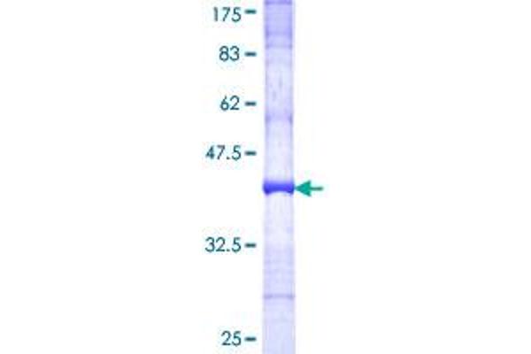 Patched 2 Protein (PTCH2) (AA 79-188) (GST tag)