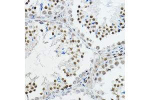 Immunohistochemistry of paraffin-embedded mouse testis using NCOR1 Rabbit pAb (ABIN6130574, ABIN6144420, ABIN6144421 and ABIN6222831) at dilution of 1:100 (40x lens). (NCOR1 anticorps  (AA 1-200))
