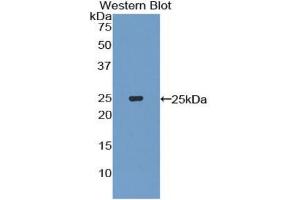 Western blot analysis of the recombinant protein. (IL-27 anticorps  (AA 29-234))