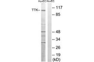 Western blot analysis of extracts from HuvEc cells, treated with etoposide 25uM 24H, using TTK (Ab-676) Antibody. (Mps1 anticorps  (AA 642-691))
