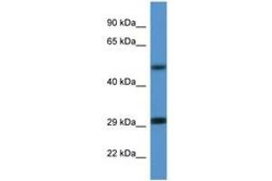 Image no. 1 for anti-Enolase 2 (Gamma, Neuronal) (ENO2) (AA 75-124) antibody (ABIN6746907) (ENO2/NSE anticorps  (AA 75-124))
