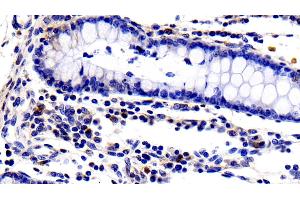 Detection of IL2Ra in Porcine Colon Tissue using Polyclonal Antibody to Interleukin 2 Receptor Alpha (IL2Ra) (CD25 anticorps  (AA 22-245))