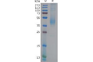 Human GFRAL Protein, His Tag on SDS-PAGE under reducing condition. (GFRAL Protein (AA 19-351) (His tag))