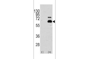 Western blot analysis of RPS6KB1 using rabbit polyclonal RPS6KB1 Antibody (S404) using 293 cell lysates (2 ug/lane) either nontransfected (Lane 1) or transiently transfected with the RPS6KB1 gene (Lane 2). (RPS6KB1 anticorps  (AA 405-434))