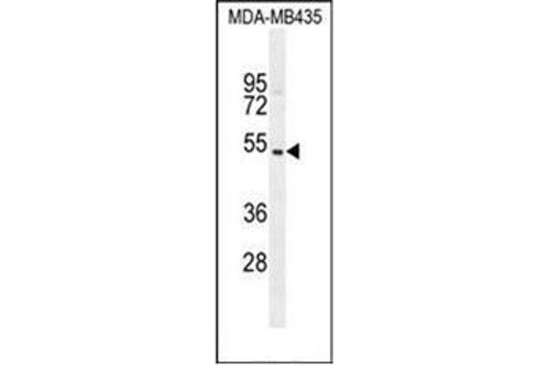 GFRAL anticorps  (C-Term)