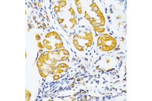 Immunohistochemistry of paraffin-embedded human stomach using MMP2 antibody. (MMP2 anticorps)