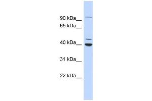 WB Suggested Anti-CTBP1 Antibody Titration:  0. (CTBP1 anticorps  (N-Term))