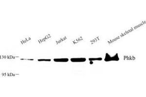 Western blot analysis of Phkb (ABIN7075075) at dilution of 1: 500 (PHKB anticorps)